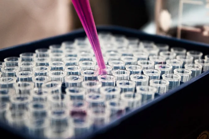 Exames medicos pcal: Microscópio laboratorial para análise de amostras queratinosas